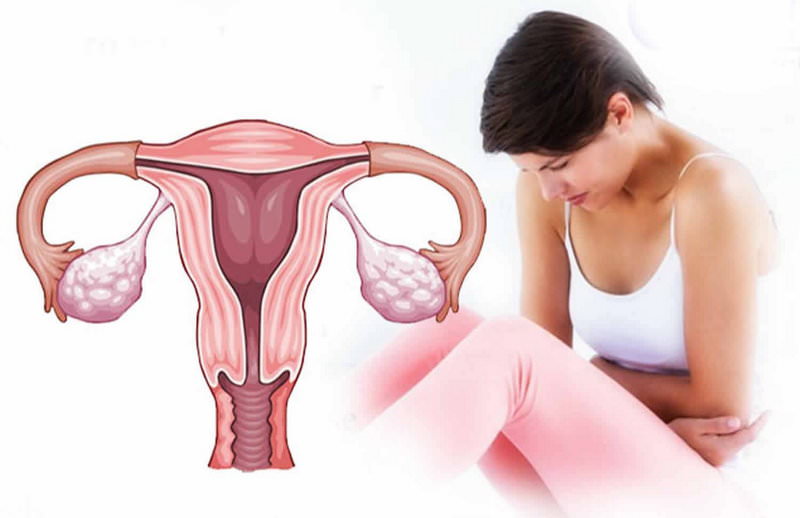 lechenie endometrioza 02